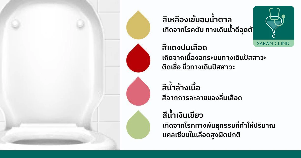 สีปัสสาวะสามารถบอกโรคเราได้ด้วยนะ
