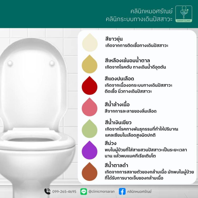 สีปัสสาวะ บอกอาการ