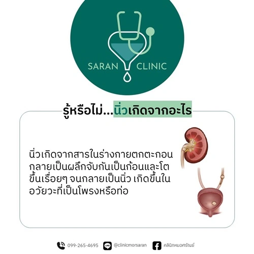 หน้านิ่วคิ้วขมวดเพราะปวดนิ่ว